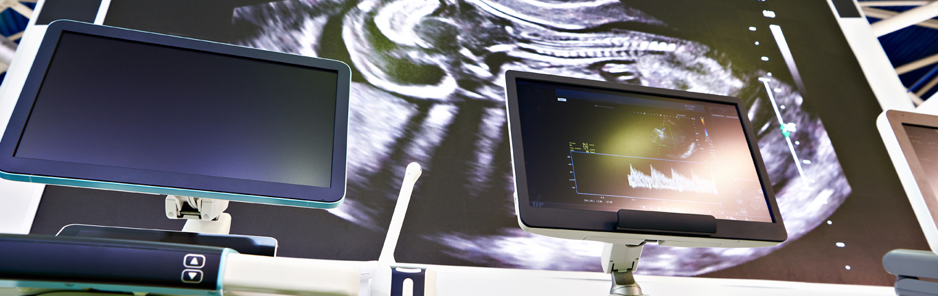 Sonogram images on screens.