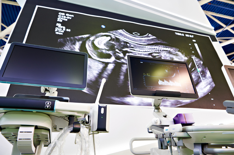 Sonogram images on screens.
