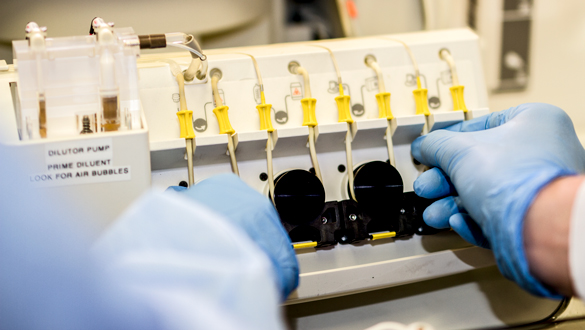 Medical Laboratory Technician student working with Dilutor Pump in lab. 